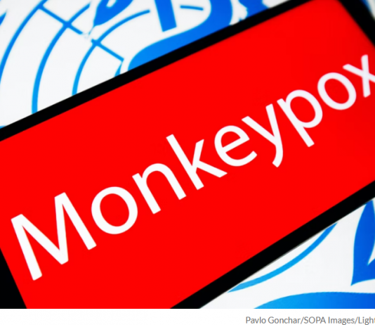 Monkeypox Cases Start To Rise Around World